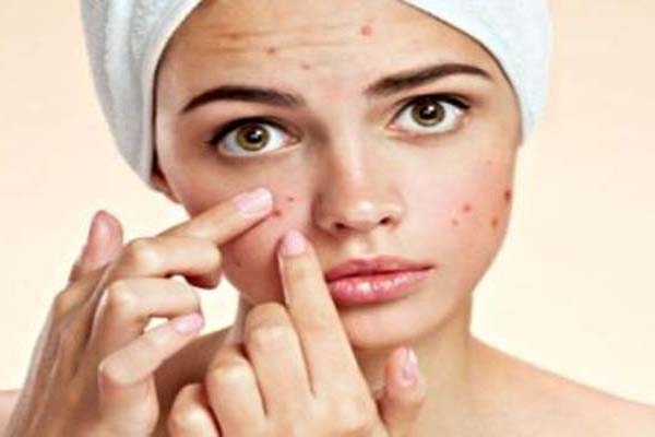 मुंहासों से बचने संतुलित व स्वास्थ्यपरक आहार लें