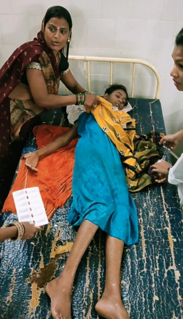 आकाशीय बिजली से झुलसी किशोरी