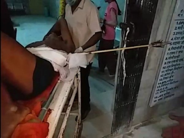 विवाद में बड़े भाई ने छोटे को तीर मारा, पेट में से बाहर निकल आईं अंतड़ियां
